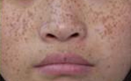 56