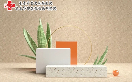 长春治疗牛皮癣医院哪家好