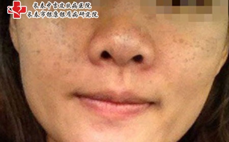 51