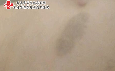 f9198618367adab435f2ab5f81d4b31c8701e488 f9198618367adab435f2ab5f81d4b31c8701e488