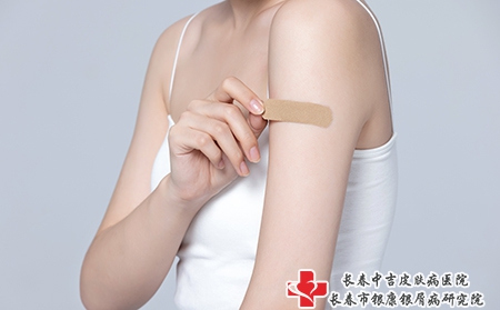 摄图网_501700725_胳膊受伤贴创可贴的女性（企业商用）