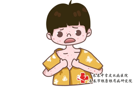 身体瘙痒是怎么回事