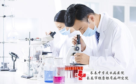 治疗牛皮癣有什么药物、软膏 治疗牛皮癣有什么药物、软膏