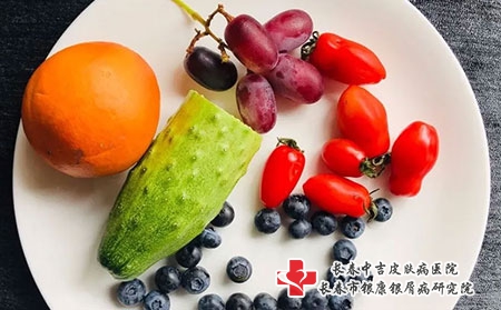 得了白癜风什么东西不能吃