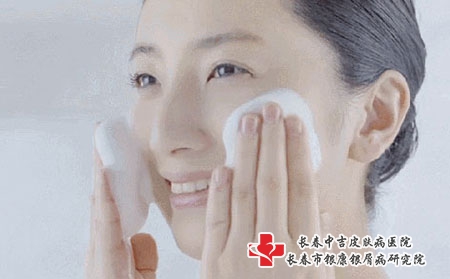牛皮癣患者在日常生活中应注意什么?