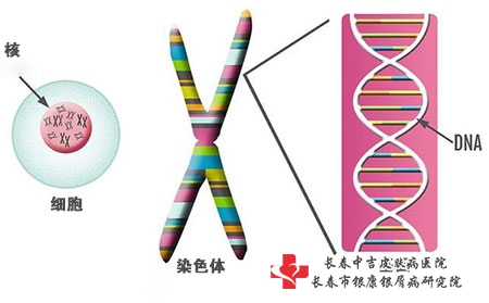 牛皮廨发作的原因是什么？