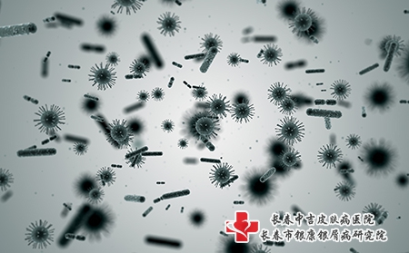 牛皮癣一般是由什么原因引起的？