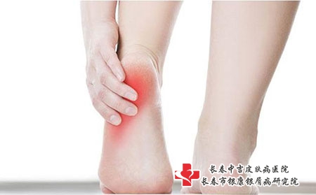 这两个部位的皮肤瘙痒一定要重视
