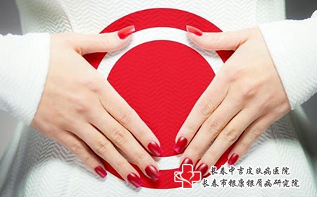 如何应对白癜风？白癜风护理