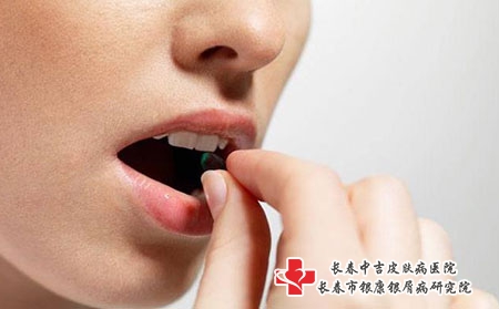 为什么白癜风容易反复发作？