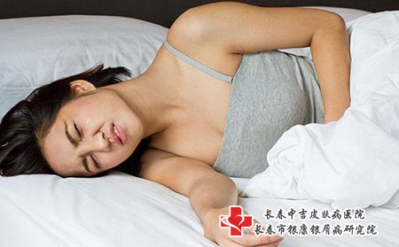 如何进行日常治疗白癜风？