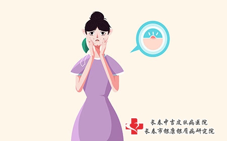 脸上痤疮形成的原因