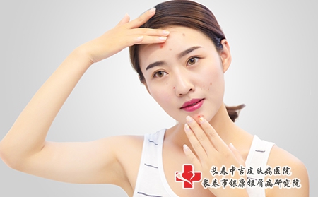 女性痤疮患者的病因及如何护理保健？