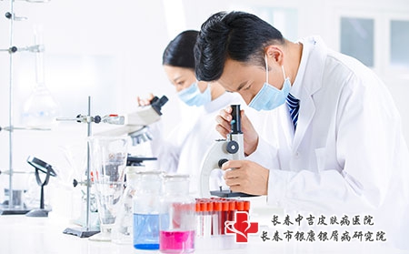 治疗银屑病的医疗方法是什么? 治疗银屑病的医疗方法是什么?