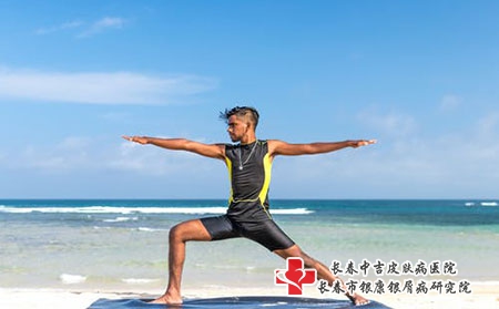 长春市哪个医院皮肤科治疗荨麻疹湿疹好？