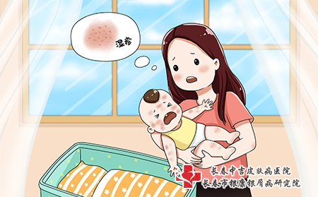 湿疹发生的原因