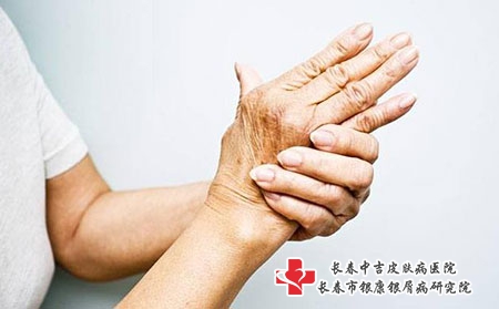皮肤上有红点浑身刺痛是患上荨麻疹了吗