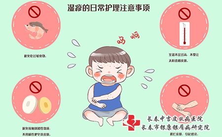 宝宝头部湿疹治疗方法