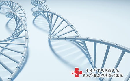 带状疱疹的治疗方法有哪些?如何治疗?