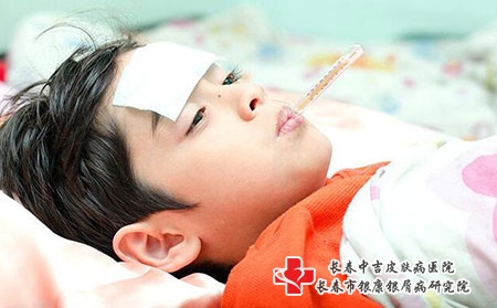 婴儿湿疹不是过敏应该如何处理?如何护理?