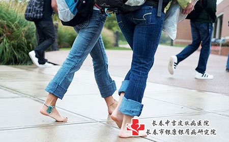 湿疹类别症状有哪些?如何治疗?饮食注意什么? 湿疹类别症状有哪些?如何治疗?饮食注意什么?
