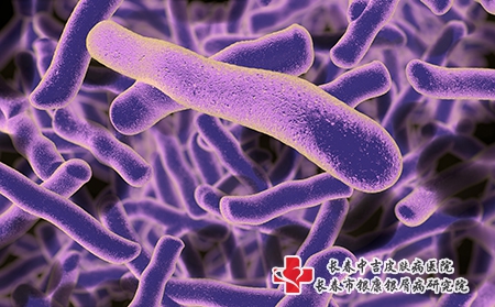 湿疹类别症状有哪些?如何治疗?饮食注意什么? 湿疹类别症状有哪些?如何治疗?饮食注意什么?