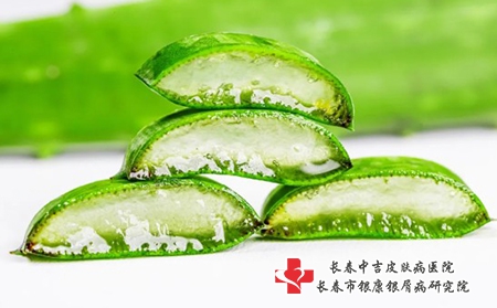 儿童为什么会患上牛皮癣呢