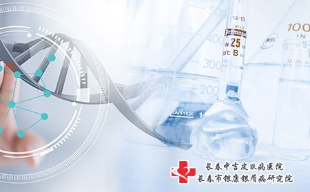 如何治疗白癜风才能减少复发呢