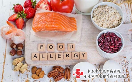 长春中吉皮肤病医院快递让邮药吗?可以邮液体的药吗?
