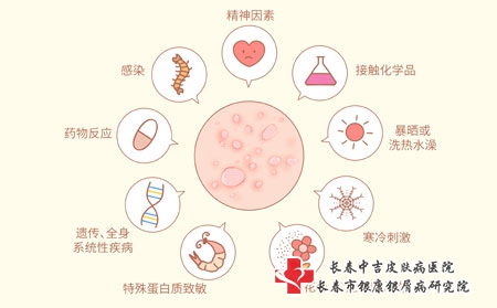 长春中吉皮肤病医院疫情期间快递邮药可以吗