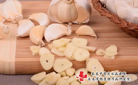 长春中吉皮肤病医院:药能不能邮快递? 长春中吉皮肤病医院:药能不能邮快递?