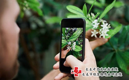 不幸患上荨麻疹怎么治疗比较好?