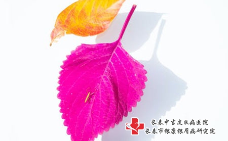 白癜风与免疫系统失常有关，该如何治疗呢