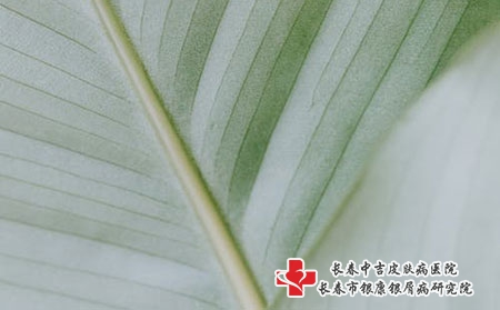 治疗荨麻疹期间需要注意什么?