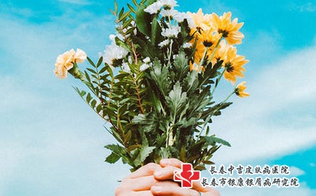 长春看儿童牛皮癣的医院