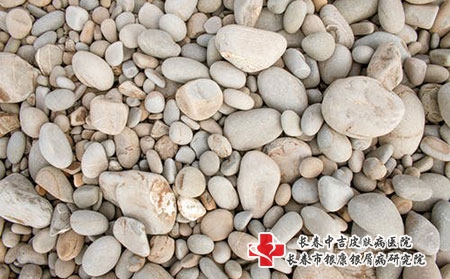 预防荨麻疹的方法都有哪些?