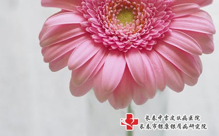 荨麻疹会越来越严重吗