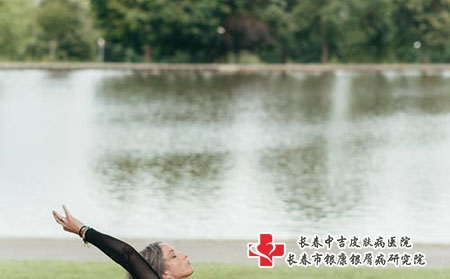 在夏季不幸患上不皮癣 该怎么治疗 在夏季不幸患上不皮癣 该怎么治疗