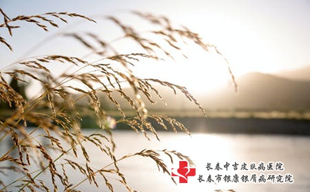 在白城如何有效的治好顽固的牛皮癣 在白城如何有效的治好顽固的牛皮癣