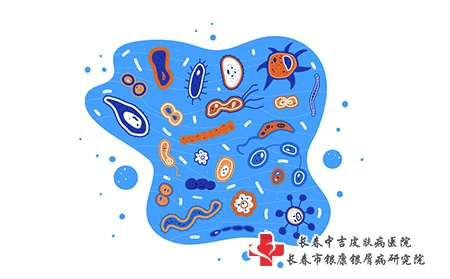 儿童白癜风的诱因有哪些?应该如何防治?