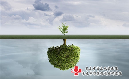 牛皮癣会导致关节损伤吗?危害有哪些?