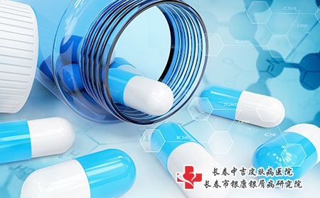 长春朝阳区治牛皮癣哪个医院好
