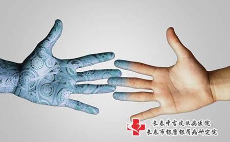 哪些食物容易诱发湿疹?湿疹不能滥用药! 哪些食物容易诱发湿疹?湿疹不能滥用药!