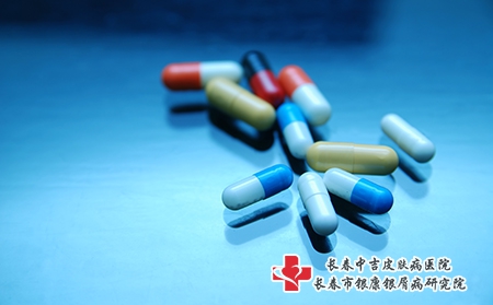长春哪个医院看牛皮癣疗效好