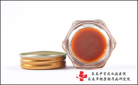 患上玫瑰痤疮应该注意哪些事项?