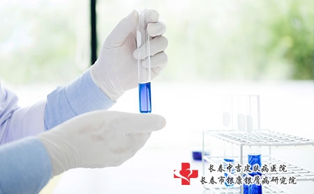 过敏性皮炎要注意什么?日常禁忌有哪些?