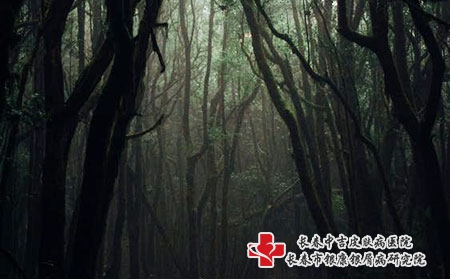 长春牛皮癣医院的地址?牛皮癣诊断时有什么原则