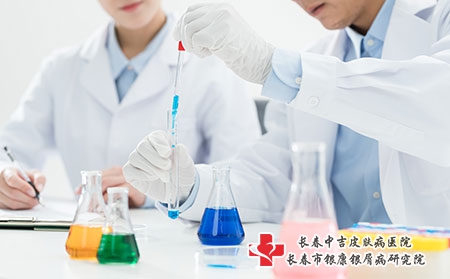 长春牛皮癣去哪里治疗?牛皮癣的预防措施有哪些