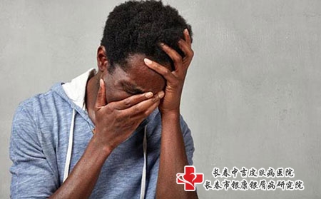 【长春哪一个医院看牛皮癣好点】怎样帮助老年人治好牛皮癣