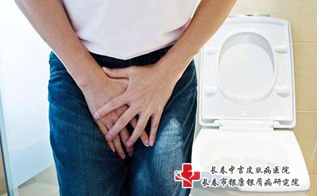 [中吉皮肤病医院微信号]长春白癜风医院哪个治疗专业
